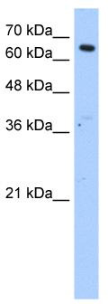 WB Suggested Anti-FAR1 Antibody Titration: 1.25 ug/ml; Positive Control: HepG2 cell lysate