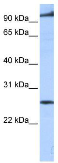 WB Suggested Anti-PPAPDC1B Antibody Titration: 0.2-1 ug/ml; Positive Control: Human brain