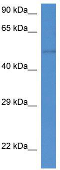 WB Suggested Anti-St6gal2 Antibody; Titration: 1.0 ug/ml; Positive Control: Mouse Small Intestine