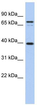 WB Suggested Anti-MS4A14 Antibody Titration: 0.2-1 ug/ml; ELISA Titer: 1: 312500; Positive Control: PANC1 cell lysate
