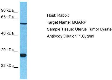 Host: Rabbit; Target Name: MGARP; Sample Tissue: Uterus Tumor lysates; Antibody Dilution: 1.0 ug/ml