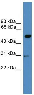 WB Suggested Anti-GAL3ST3 Antibody Titration: 0.2-1 ug/ml; ELISA Titer: 1: 1562500; Positive Control: MCF7 cell lysate