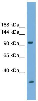 WB Suggested Anti-CDHR1 Antibody Titration: 0.2-1 ug/ml; ELISA Titer: 1: 1562500; Positive Control: Human heart
