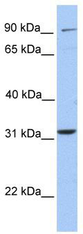 WB Suggested Anti-ELFN2 Antibody Titration: 0.2-1 ug/ml; Positive Control: 721_B cell lysate