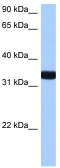 WB Suggested Anti-GIMAP1 Antibody Titration: 0.2-1 ug/ml; Positive Control: Hela cell lysate