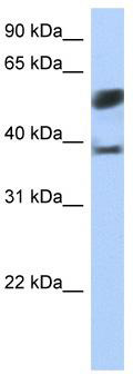 WB Suggested Anti-SPOPL Antibody Titration: 0.2-1 ug/ml; Positive Control: Jurkat cell lysate