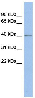 WB Suggested Anti-SPOPL Antibody Titration: 0.2-1 ug/ml; ELISA Titer: 1: 312500; Positive Control: PANC1 cell lysate