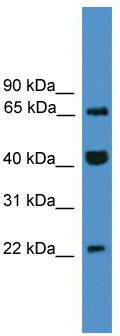 WB Suggested Anti-TCEAL6 Antibody Titration: 0.2-1 ug/ml; ELISA Titer: 1: 312500; Positive Control: Jurkat cell lysate