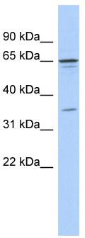 WB Suggested Anti-ZNF648 Antibody Titration: 0.2-1 ug/ml; ELISA Titer: 1: 312500; Positive Control: COLO205 cell lysate