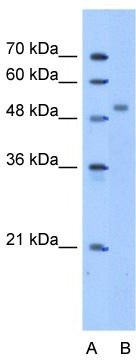 WB Suggested Anti-ZNF763 Antibody Titration: 5.0 ug/ml; Positive Control: HepG2 cell lysate
