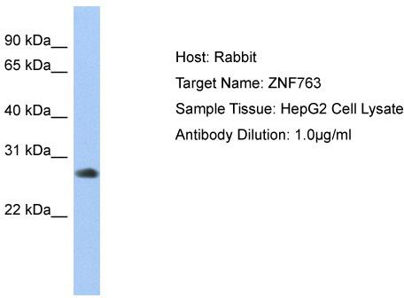 Host: Rabbit; Target Name: ZNF763; Sample Tissue: HepG2 Whole cell lysates; Antibody Dilution: 1.0 ug/ml