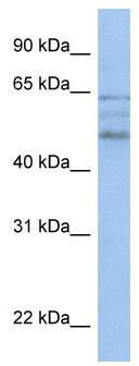 WB Suggested Anti-MSS51 Antibody Titration: 0.2-1 ug/ml; Positive Control: HepG2 cell lysate