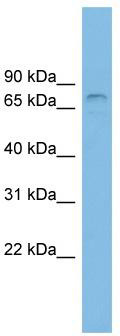 WB Suggested Anti-ZNF816 Antibody Titration: 0.2-1 ug/ml; ELISA Titer: 1: 62500; Positive Control: HT1080 cell lysate