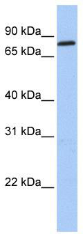 WB Suggested Anti-ZNF226 Antibody Titration: 0.2-1 ug/ml; Positive Control: 721_B cell lysate