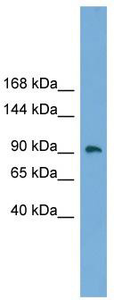 WB Suggested Anti-ZNF226 Antibody Titration: 0.2-1 ug/ml; ELISA Titer: 1: 312500; Positive Control: Human Placenta