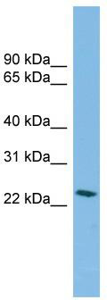 WB Suggested Anti-SSX4B Antibody Titration: 0.2-1 ug/ml; ELISA Titer: 1: 62500; Positive Control: Human kidney