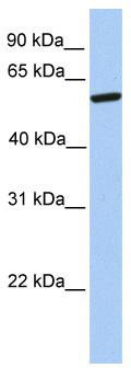 WB Suggested Anti-ZNF284 Antibody Titration: 0.2-1 ug/ml; Positive Control: 721_B cell lysate