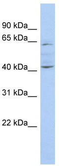 WB Suggested Anti-ZNF674 Antibody Titration: 0.2-1 ug/ml; ELISA Titer: 1: 312500; Positive Control: COLO205 cell lysate