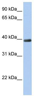 WB Suggested Anti-ZNF391 Antibody Titration: 0.2-1 ug/ml; Positive Control: 721_B cell lysate ZNF391 is supported by BioGPS gene expression data to be expressed in 721_B