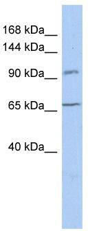 WB Suggested Anti-COG5 Antibody Titration: 0.2-1 ug/ml; ELISA Titer: 1: 312500; Positive Control: THP-1 cell lysate