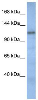 WB Suggested Anti-CAND2 Antibody Titration: 0.2-1 ug/ml; ELISA Titer: 1: 62500; Positive Control: Human Muscle