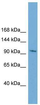 WB Suggested Anti-STK31 Antibody Titration: 0.2-1 ug/ml; Positive Control: HepG2 cell lysate