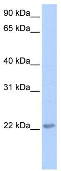WB Suggested Anti-TCEAL2 Antibody Titration: 0.2-1 ug/ml; Positive Control: HepG2 cell lysate