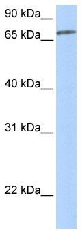 WB Suggested Anti-ZNF418 Antibody Titration: 0.2-1 ug/ml; Positive Control: MCF7 cell lysate