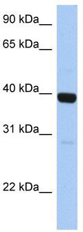 WB Suggested Anti-ZNF385B Antibody Titration: 0.2-1 ug/ml; Positive Control: Human Liver