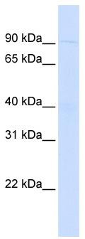WB Suggested Anti-WDFY3 Antibody Titration: 0.2-1 ug/ml; ELISA Titer: 1: 12500; Positive Control: Human Muscle