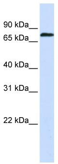 WB Suggested Anti-ZNF714 Antibody Titration: 0.2-1 ug/ml; ELISA Titer: 1: 1562500; Positive Control: Human Muscle