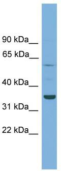 WB Suggested Anti-C3orf67 Antibody Titration: 0.2-1 ug/ml; ELISA Titer: 1: 312500; Positive Control: OVCAR-3 cell lysate