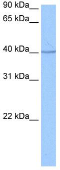 WB Suggested Anti-SP6 Antibody Titration: 0.2-1 ug/ml; Positive Control: Jurkat cell lysate