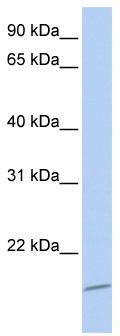 WB Suggested Anti-ASCL4 Antibody Titration: 0.2-1 ug/ml; ELISA Titer: 1: 312500; Positive Control: MCF7 cell lysate