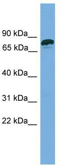 WB Suggested Anti-ZNF790 Antibody Titration: 0.2-1 ug/ml; Positive Control: 721_B cell lysate