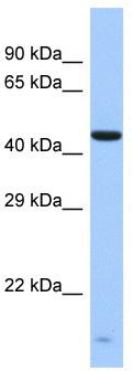 Host: Rabbit; Target Name: ZNF701; Sample Tissue: Fetal Liver lysates; Antibody Dilution: 1.0 ug/ml