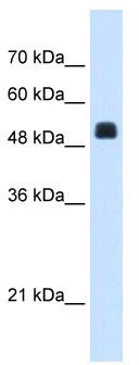 WB Suggested Anti-NAGS Antibody Titration: 1.25 ug/ml; Positive Control: HepG2 cell lysate