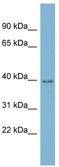 WB Suggested Anti-ENKD1 Antibody Titration: 0.2-1 ug/ml; Positive Control: THP-1 cell lysate