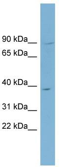 WB Suggested Anti-ENKD1 Antibody Titration: 0.2-1 ug/ml; ELISA Titer: 1: 312500; Positive Control: PANC1 cell lysate