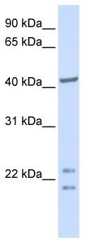 Gel: 12%SDS-PAGE<br>Lysate: 60 μg<br>Lane: 293T cell<br>Primary antibody: TA369341 (SENP8 Antibody) at dilution 1/400<br>Secondary antibody: Goat anti rabbit IgG at 1/8000 dilution<br>Exposure time: 15 seconds