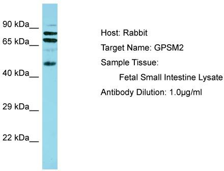Gel: 8%SDS-PAGE<br>Lysate: 40 μg<br>Lane: HepG2 cells<br>Primary antibody: TA369342 (SEPTIN2 Antibody) at dilution 1/400<br>Secondary antibody: Goat anti rabbit IgG at 1/8000 dilution<br>Exposure time: 10 seconds