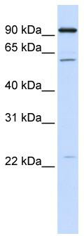 WB Suggested Anti-CDC45 Antibody Titration: 0.2-1 ug/ml; ELISA Titer: 1: 12500; Positive Control: Hela cell lysateCDC45 is supported by BioGPS gene expression data to be expressed in HeLa