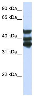 WB Suggested Anti-HGD Antibody Titration: 0.2-1 ug/ml; ELISA Titer: 1: 1562500; Positive Control: Hela cell lysate
