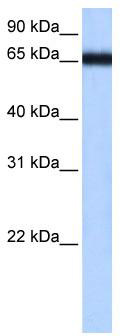 WB Suggested Anti-ZNF14 Antibody Titration: 0.2-1 ug/ml; Positive Control: Hela cell lysate