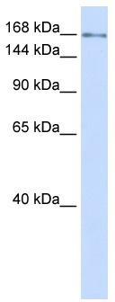 WB Suggested Anti-IFT172 Antibody Titration: 0.2-1 ug/ml; ELISA Titer: 1: 312500; Positive Control: Human Lung