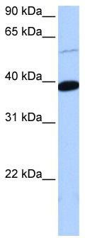 WB Suggested Anti-ZNF562 Antibody Titration: 0.2-1 ug/ml; Positive Control: 721_B cell lysate. ZNF562 is supported by BioGPS gene expression data to be expressed in 721_B