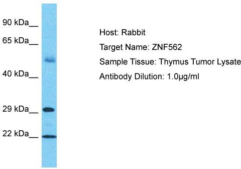 Host: Rabbit; Target Name: ZNF562; Sample Tissue: Thymus Tumor lysates; Antibody Dilution: 1.0 ug/ml