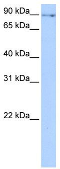WB Suggested Anti-NUFIP2 Antibody Titration: 0.2-1 ug/ml; Positive Control: NTERA2 cell lysate
