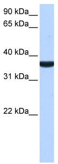 WB Suggested Anti-TP53I13 Antibody Titration: 0.2-1 ug/ml; Positive Control: Human Liver