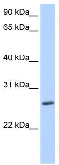 WB Suggested Anti-ZNF664 Antibody Titration: 0.2-1 ug/ml; Positive Control: Jurkat cell lysate